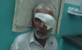 Free Eye Camp # 35